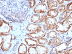 HSP60 Antibody (HSPD1/780), Novus Biologicals 0.2mg; Unlabeled:Antibodies,
